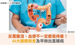 反覆腹瀉、血便不一定都是痔瘡！AI大腸鏡檢查及早揪出直腸癌