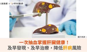 一次抽血掌握肝臟健康！及早發現、及早治療，降低肝病風險