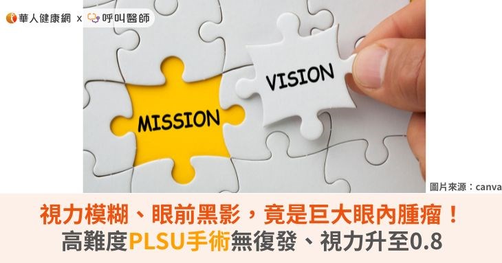 視力模糊、眼前黑影,竟是巨大眼內腫瘤!高難度PLSU手術無復發、視力升至0.8